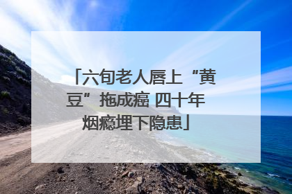 六旬老人唇上“黄豆”拖成癌 四十年烟瘾埋下隐患